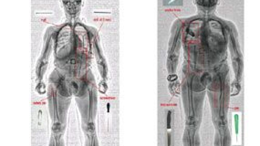 SecurPass allows for full body cavity imaging