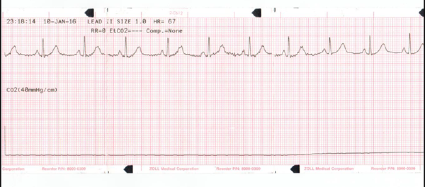 SGA_Waveform_600.png