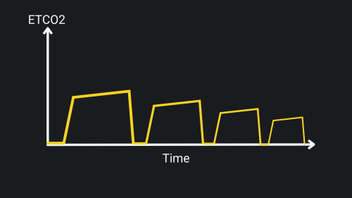 Hyperventilation capnography waveform.png