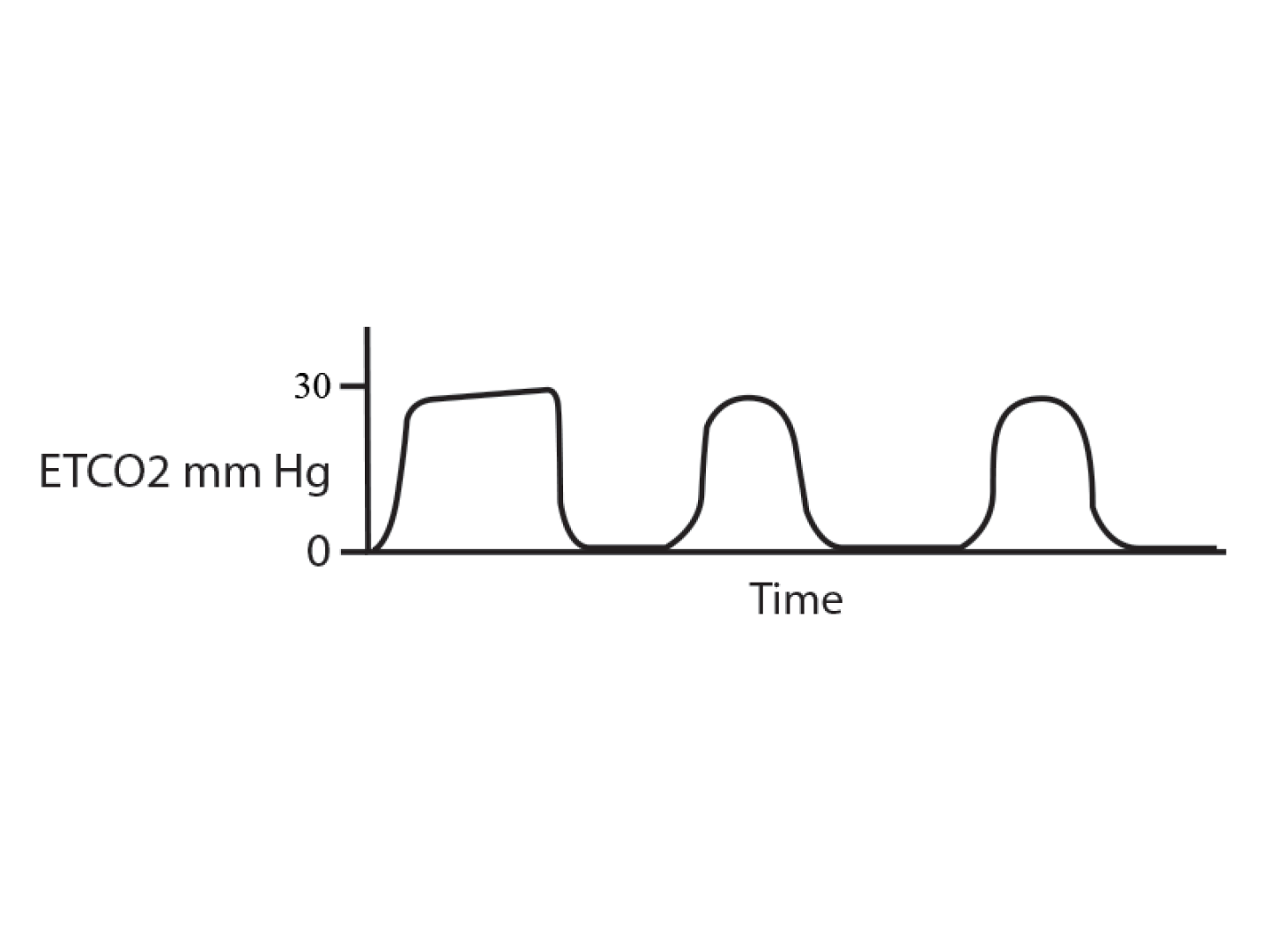 Obstructive Pattern Capnography 4 things paramedics need to know about capnography and heart failure