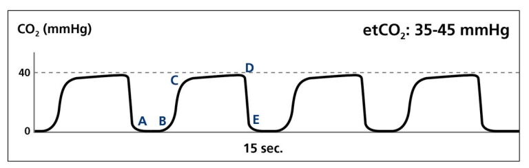 EtCO2 Monitoring You re Doing The Right Thing etco2-monitoring-you-re-doing-the-right-thing