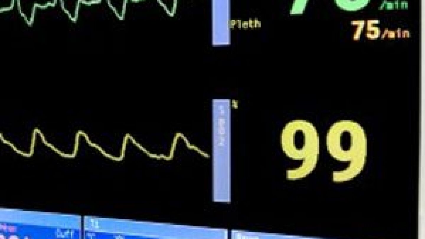 EKG rhythm identification | 10 steps from EMS1.com