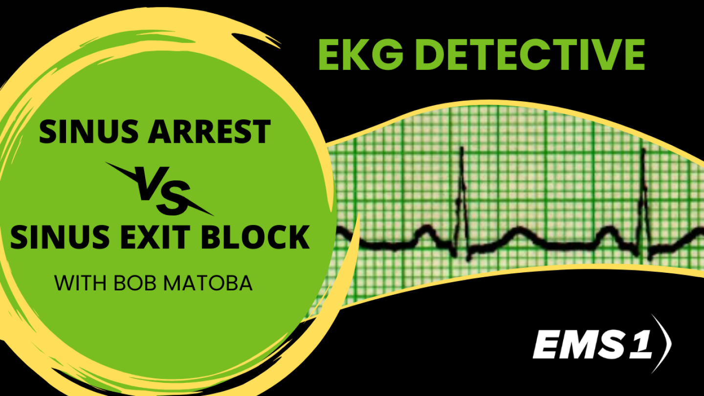 EKG Detective Sinus arrest vs. sinus exit block