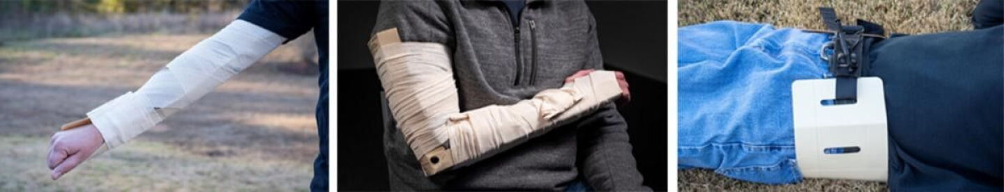 Tactical Rise Splints Tactical Medical Solutions introduces the RISETM
