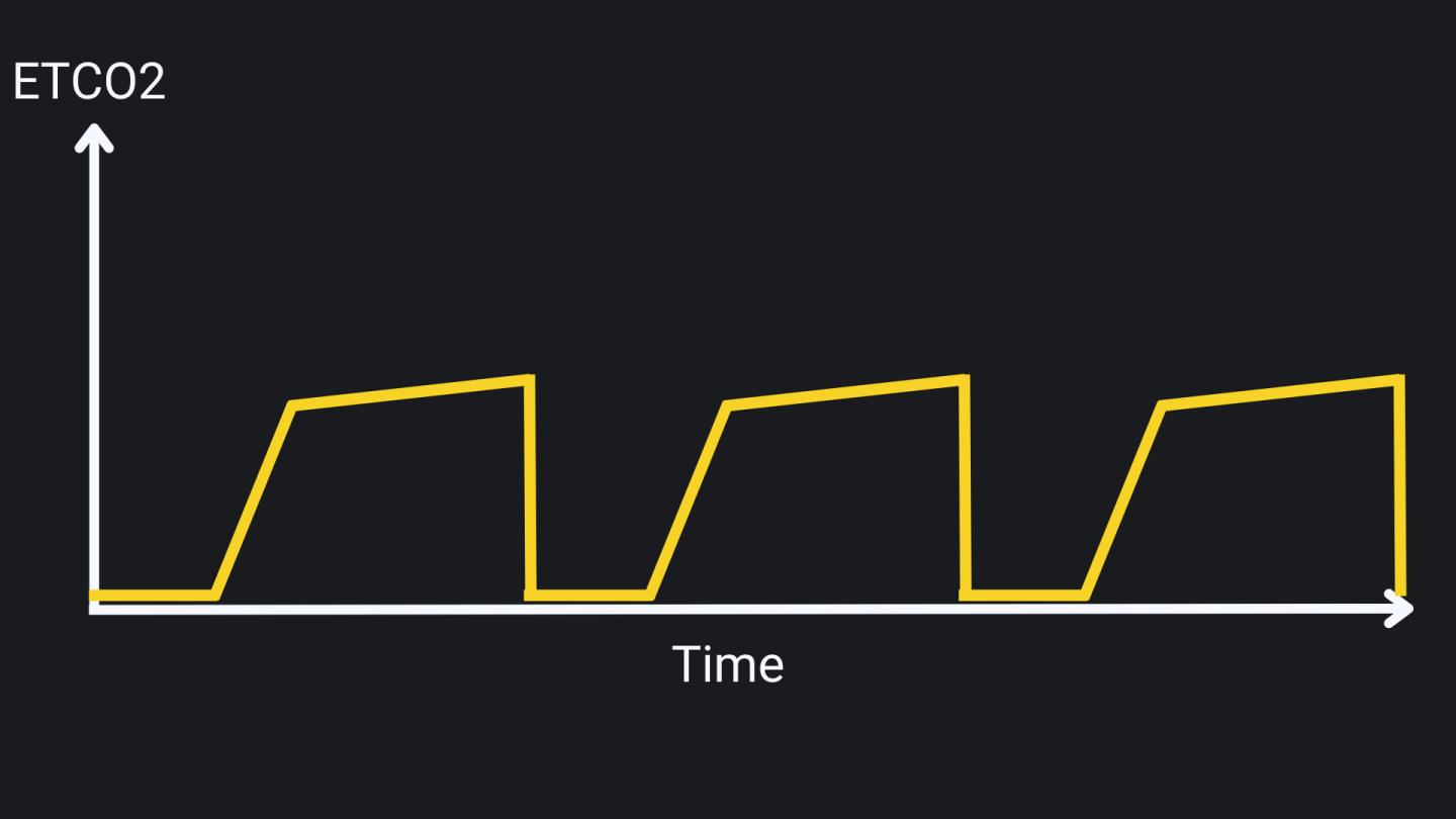 Normal Waveform.png