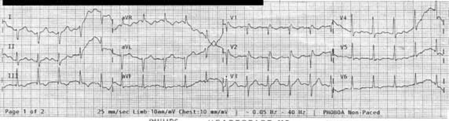 1020-ekg-small-5.jpg