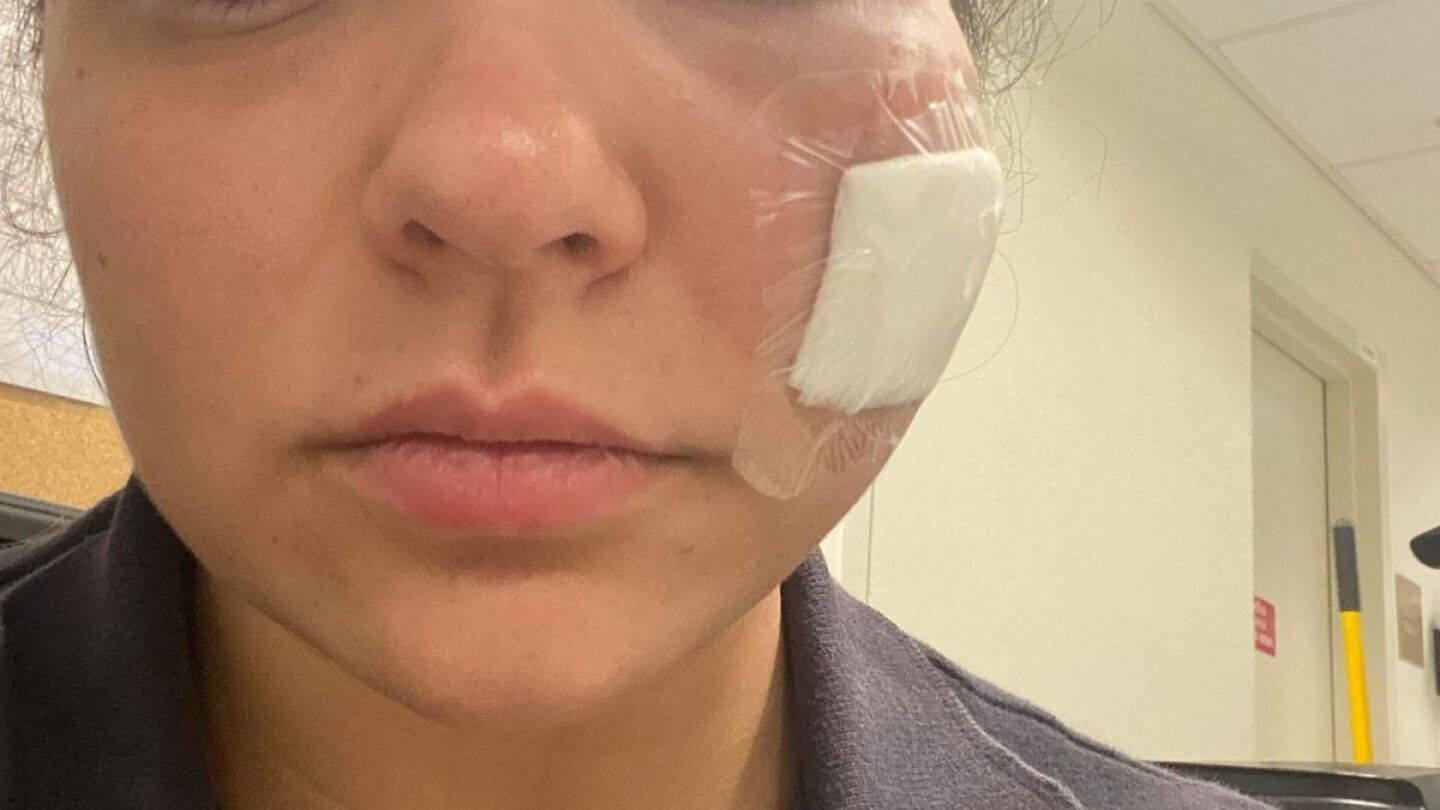 fdny ems biting attack community reacts