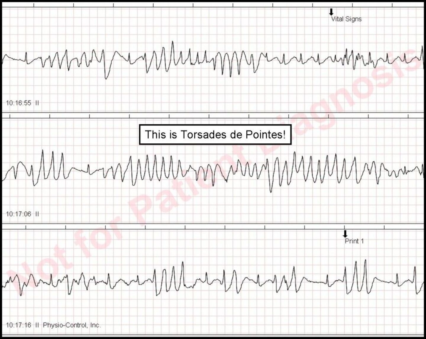 ECG Solution – Get to the point!