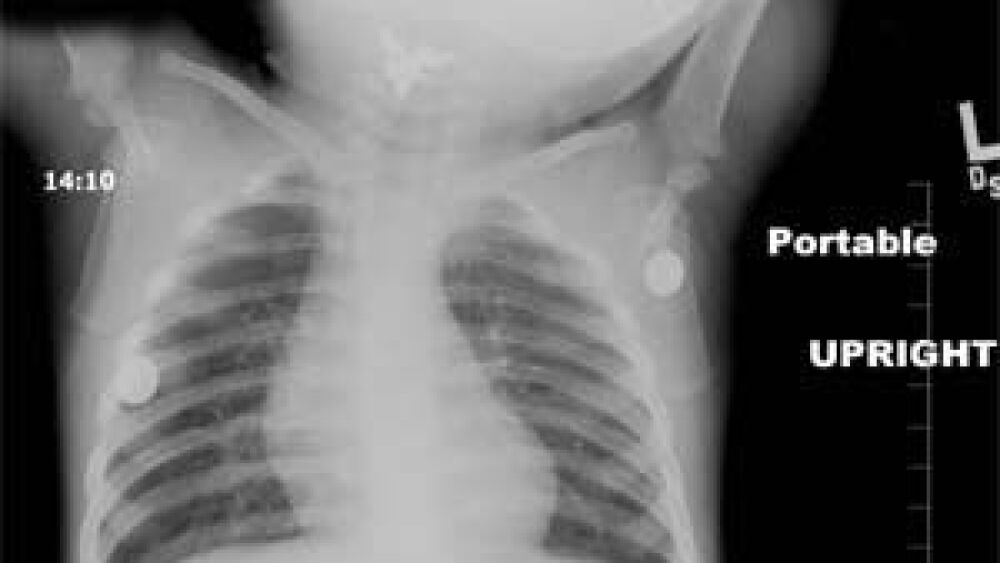 donovan-xray.jpg