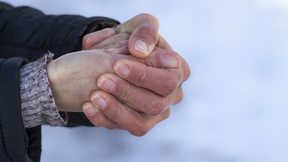 Red hands in the cold.Risk of frostbite of hand or fingers outdoors during cold weather because of frost in winter.