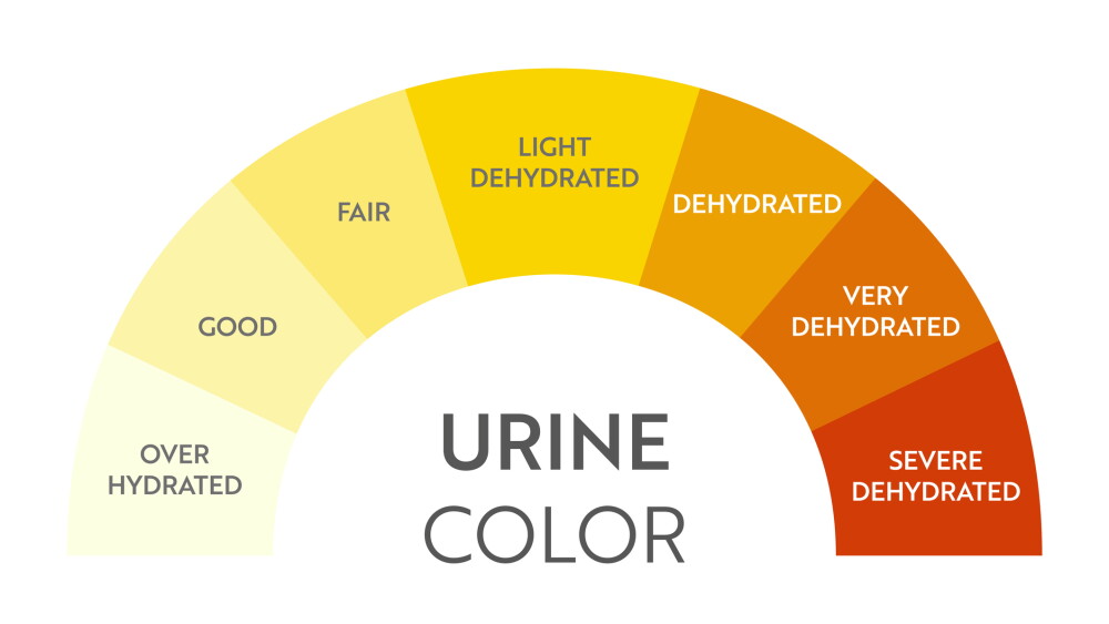 Proper Urine Color Pee color chart: Assessing hydration levels for first responders